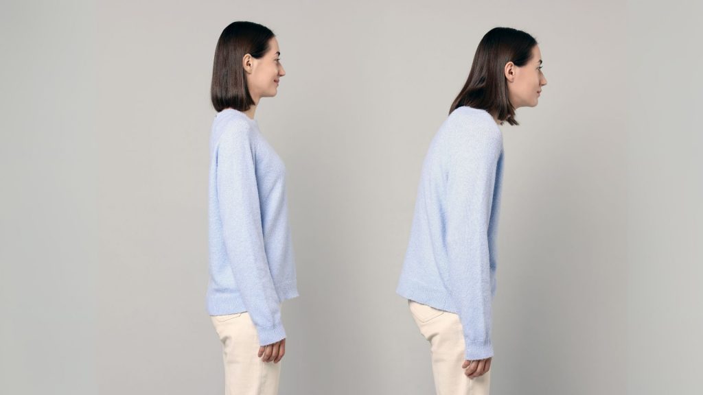 Side view comparison showing poor posture versus improved posture after child posture correction.