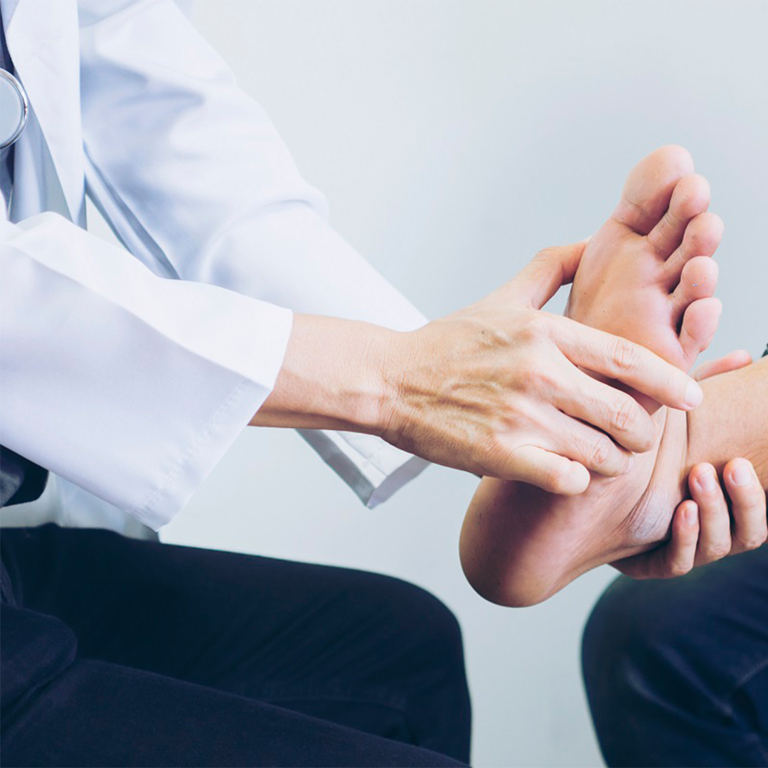 Flat Feet