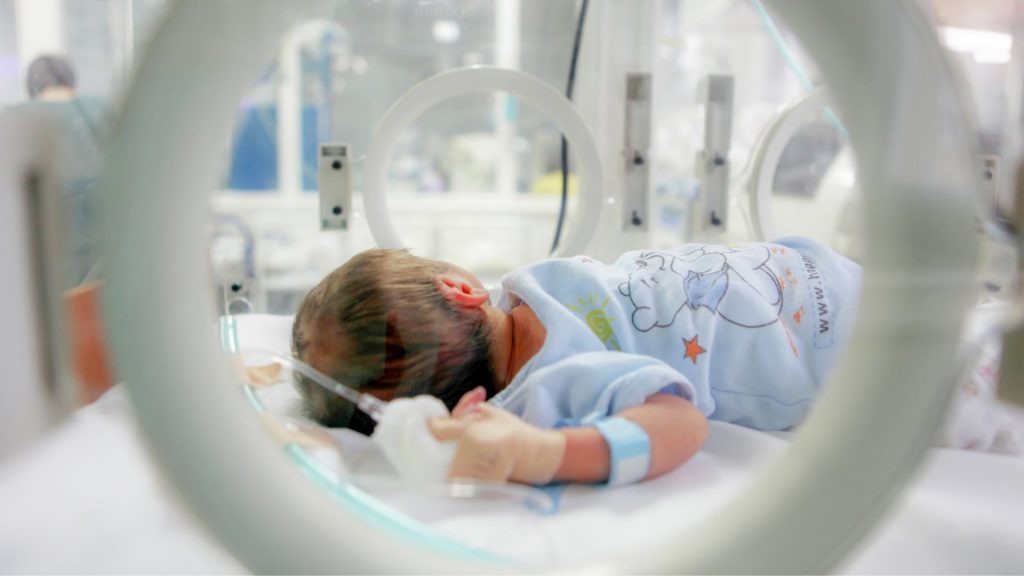 A premature baby lying in an incubator, a common factor associated with delayed motor development milestones.
