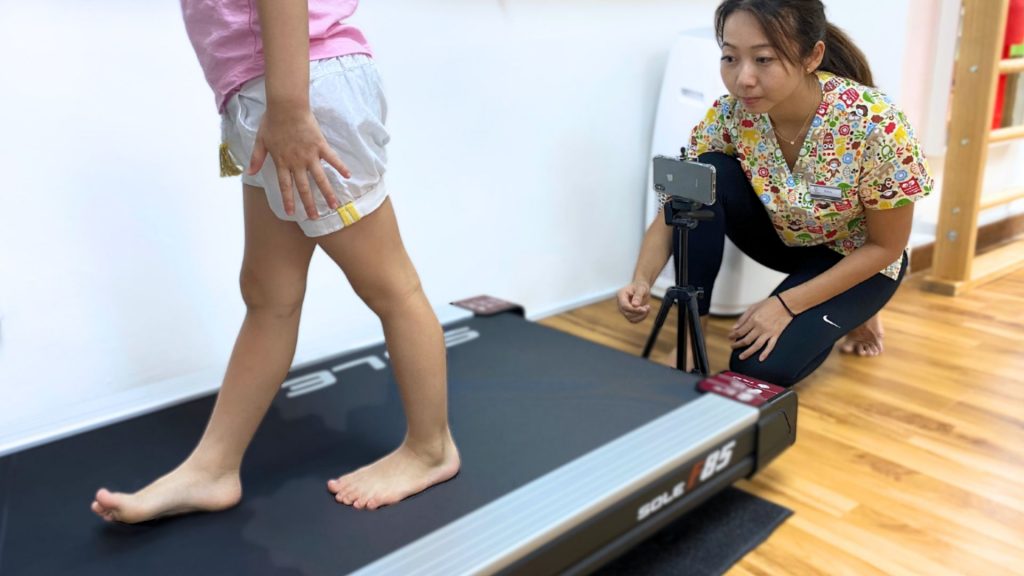 Child walking barefoot on treadmill while podiatrist performs gait assessment in Singapore clinic.