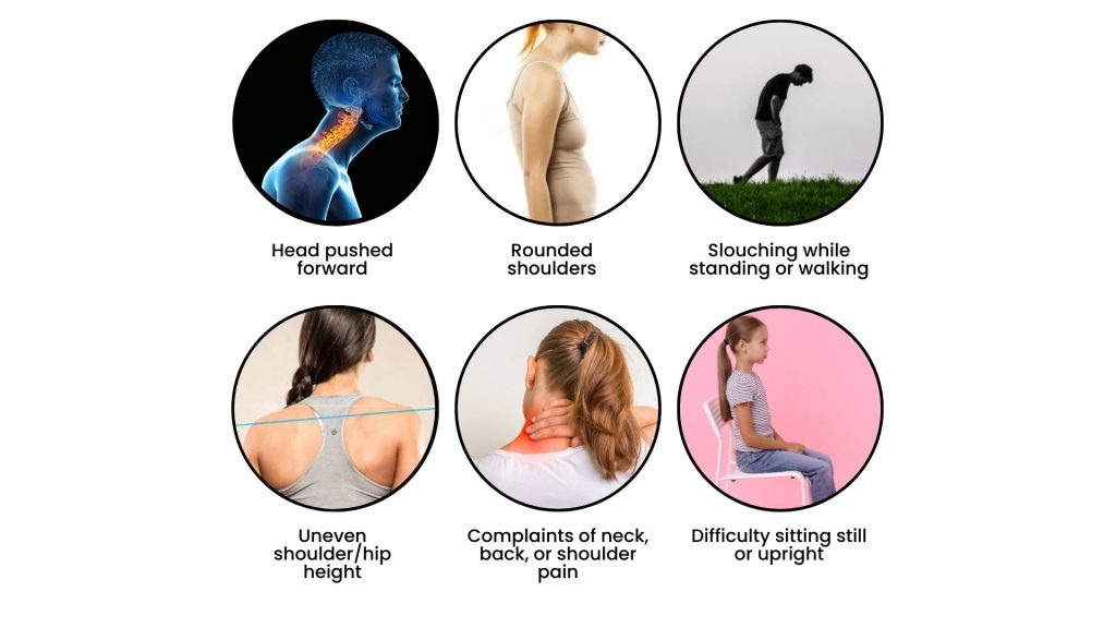 Common signs of poor posture in children, including head pushed forward, rounded shoulders, uneven hips, slouching, and difficulty sitting upright.