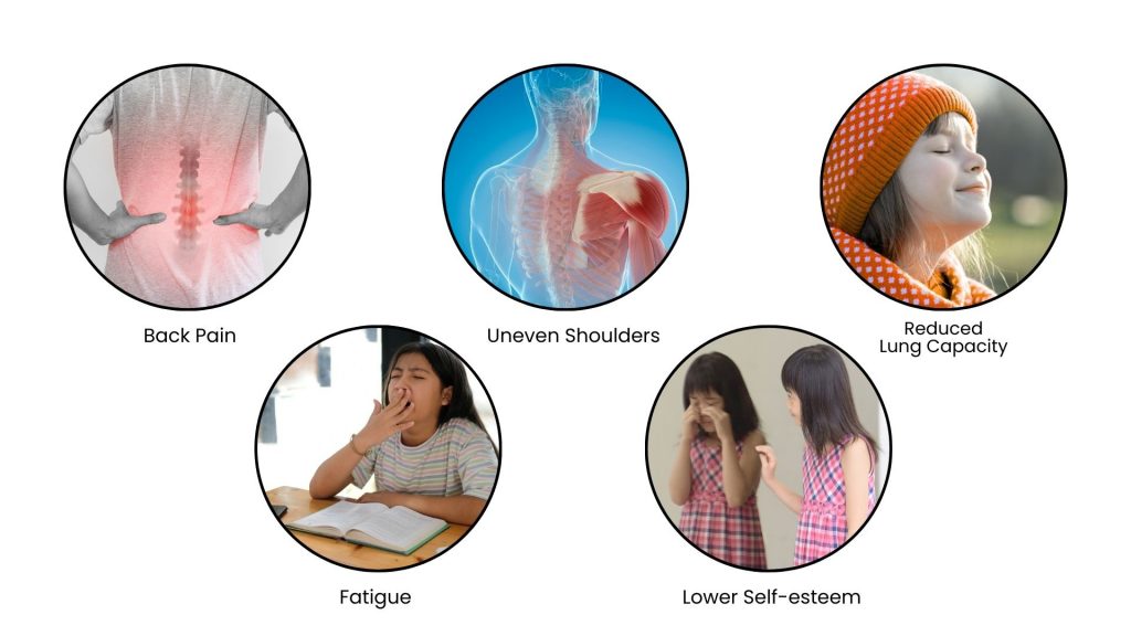 Symptoms of scoliosis in children including back pain, uneven shoulders, fatigue, reduced lung capacity, and low self-esteem
