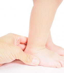 Condition/Treatment: Flat Feet